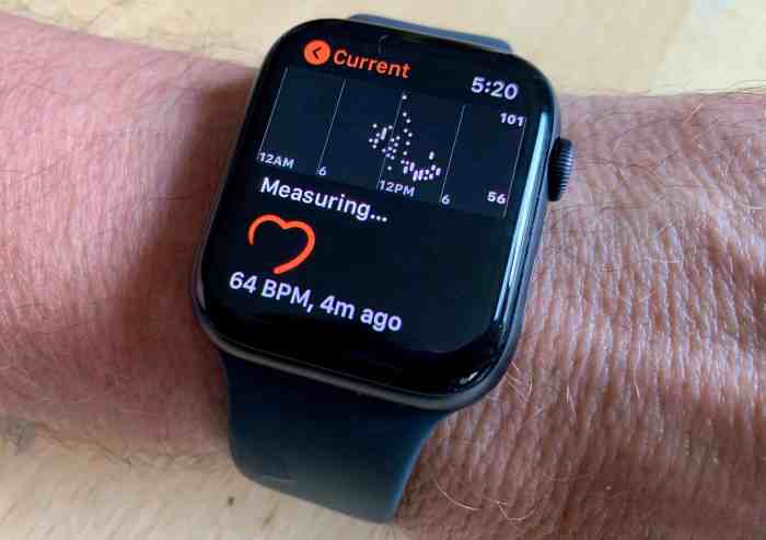 Apple watch ecg save another life 2