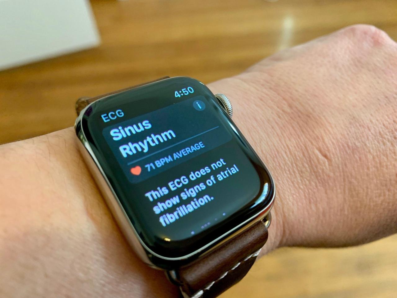 Apple watch ecg save another life 2